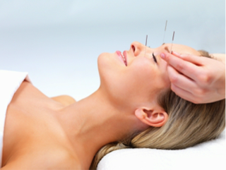 ement Acupuncture with Judy Bowen-Jones MBAcC